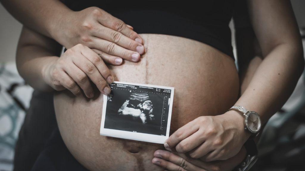 Siêu âm có thể dự đoán chính xác đến 95% giới tính em bé